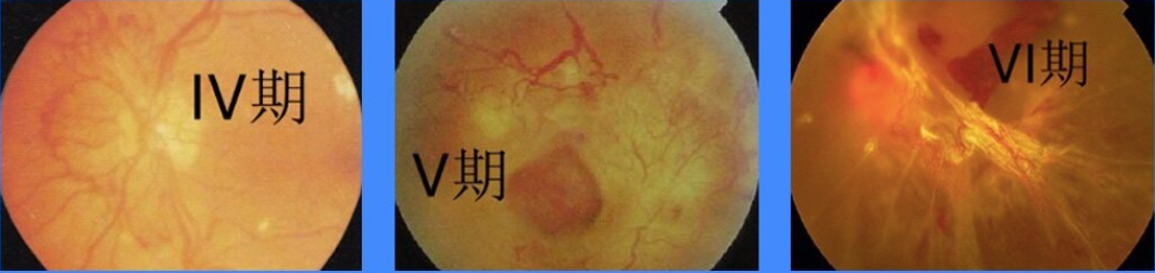 180417ry6hlczkp0lh6lrr.png