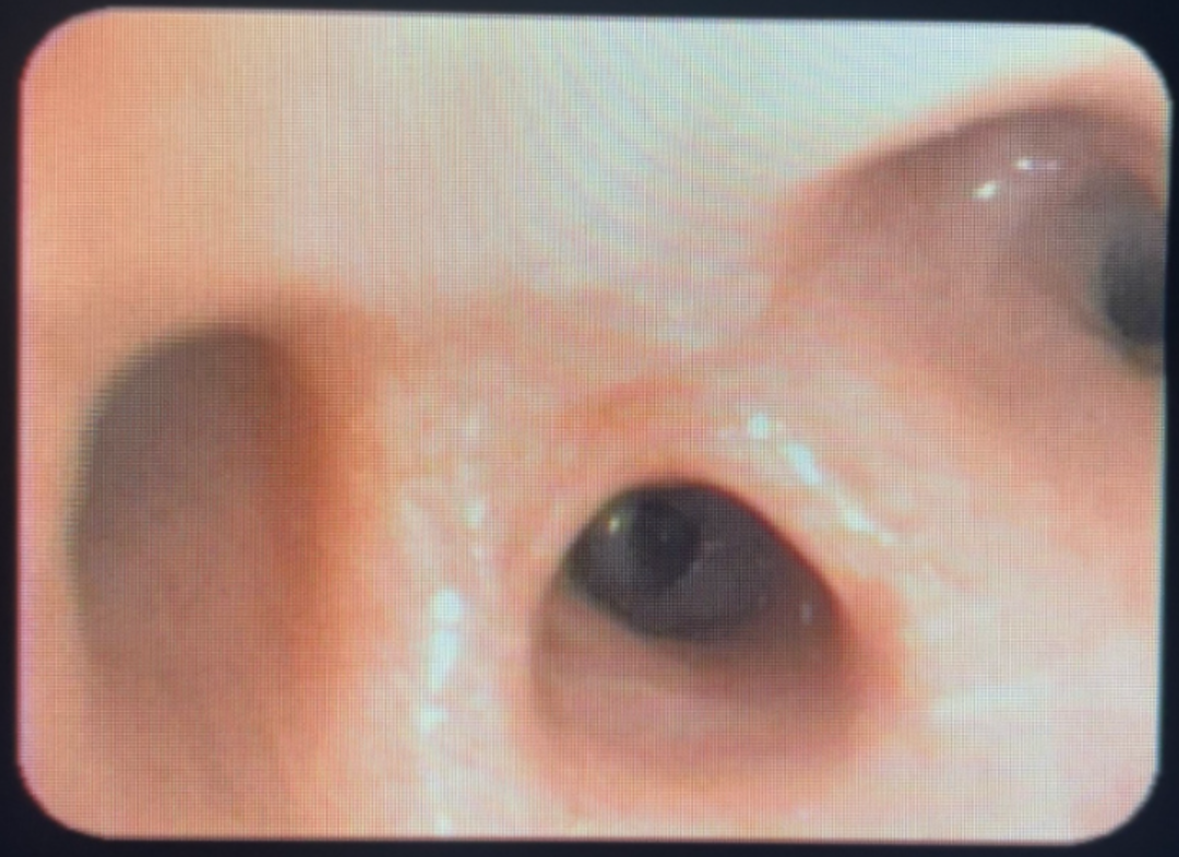 165457px9e0e9s0esinxlu.png